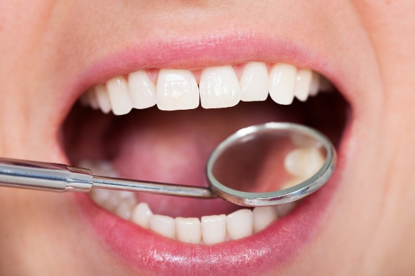 Dental Fillings: What To Expect, Types, And Potential Issues